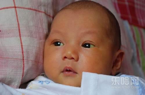 病理性黄疸的孩子有何症状,病理性黄疸症状,病