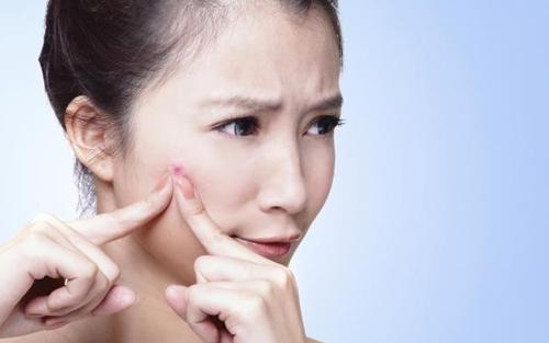 封闭性粉刺用什么药膏,去闭合性粉刺的药膏-乐