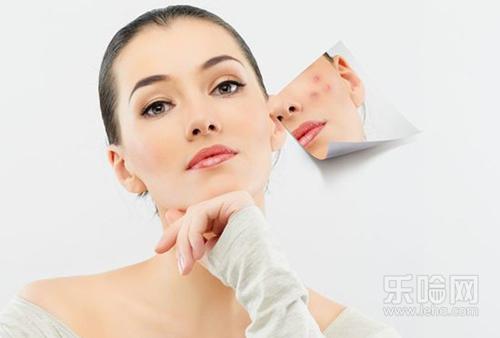 封闭性粉刺用什么药膏,去闭合性粉刺的药膏-乐