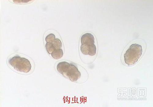 大便潜血是什么原因,大便潜血的原因,大便潜血