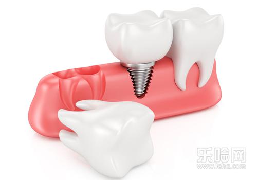 拔牙疼吗,拔牙疼不疼,拔牙痛吗-乐哈健康网