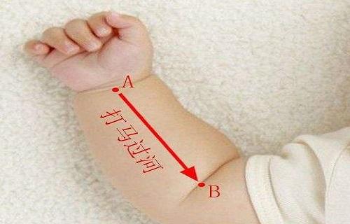 小儿发烧推拿图解手法,小儿发烧推拿多久退烧