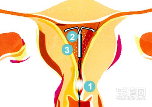 生二胎怎么老怀不上,生二胎为什么怀不上,二胎