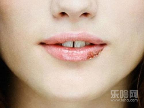 月子嘴巴起泡怎么办,坐月子嘴上起泡怎么办-乐