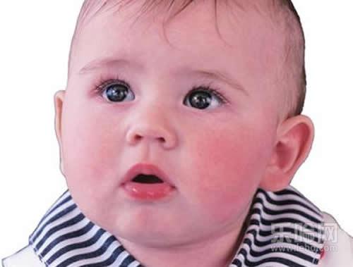 冬天小孩脸红扑扑的是什么原因,小孩冬天脸红