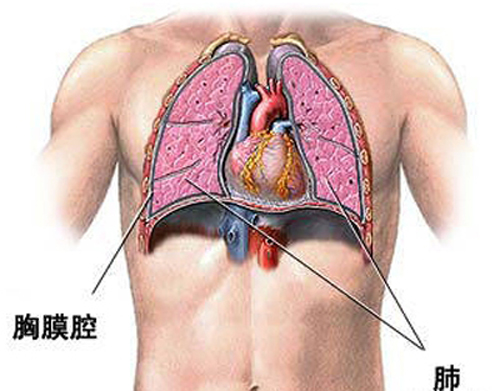 肺癌晚期胸腔积液能活多久