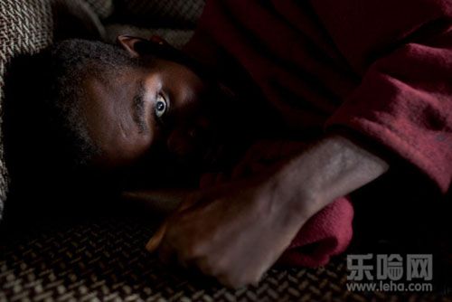 艾滋病初期症状