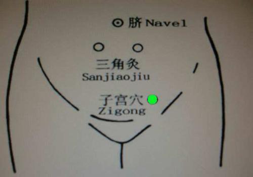 按哪个部位可以催月经 月经不调的女性快