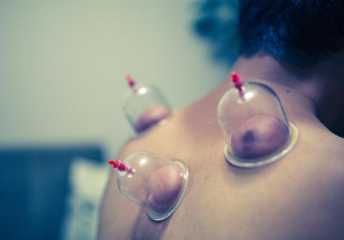 拔罐几分钟拿掉合适小孩拔罐几分钟