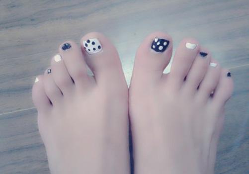 脚趾甲长到肉里怎么办 一招帮你搞定它