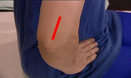 偏头疼按摩哪里最有效,偏头疼按摩哪个部位图