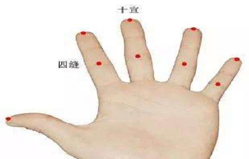 十宣放血的功效与作用 十宣放血图解（组图）