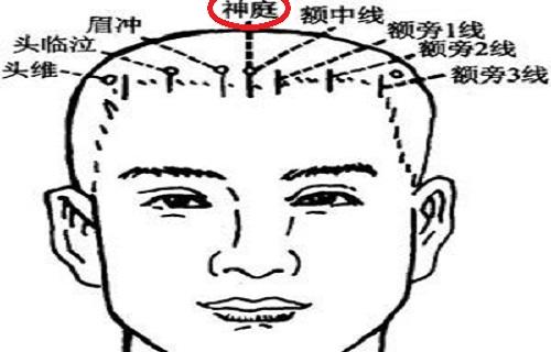神庭的准确位置图片按摩神庭的正确方法