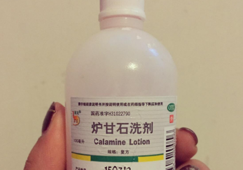 荨麻疹可以用炉甘石吗