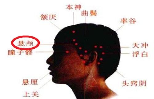 悬颅的准确位置图片悬颅疼是为什么
