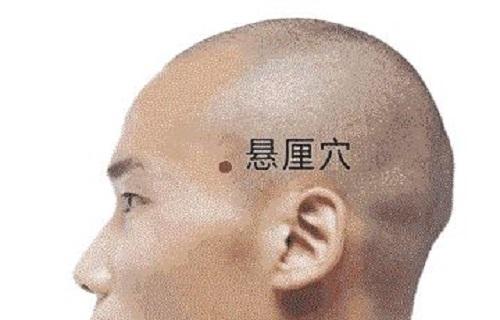 悬厘准确位置图 悬厘痛是什么病