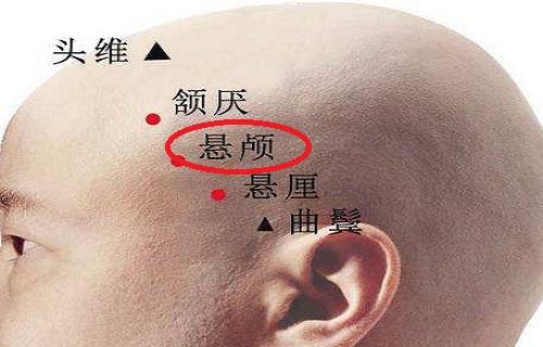 悬颅的准确位置图片悬颅疼是为什么