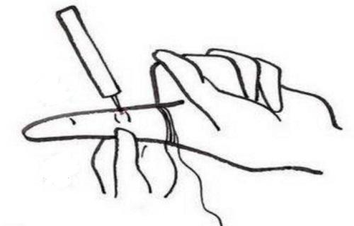 四缝放血的作用 四缝的准确位置图作用