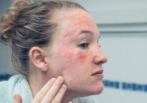 脸过敏还能用洗面奶吗