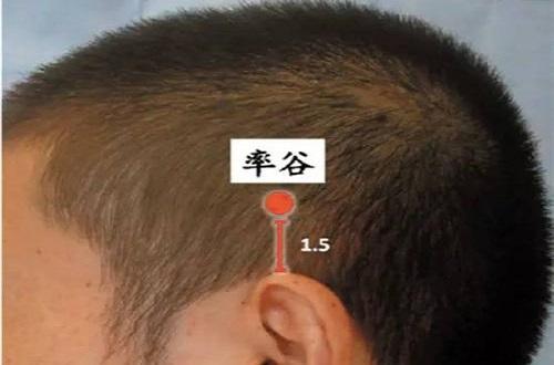 按摩哪里治疗偏头痛,偏头痛按哪里能止痛