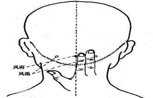 风池针刺方法 针刺风池注意事项