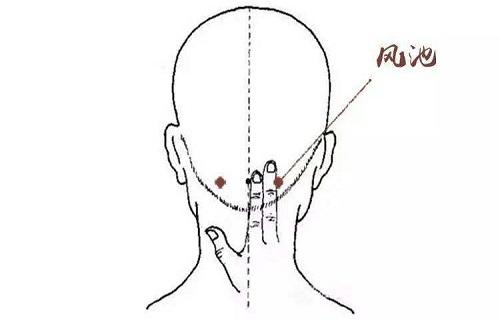 风池针刺方法 针刺风池注意事项