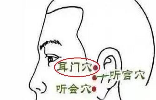 耳门针刺深度 耳门针刺方法