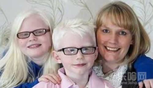 为什么要禁止近亲结婚